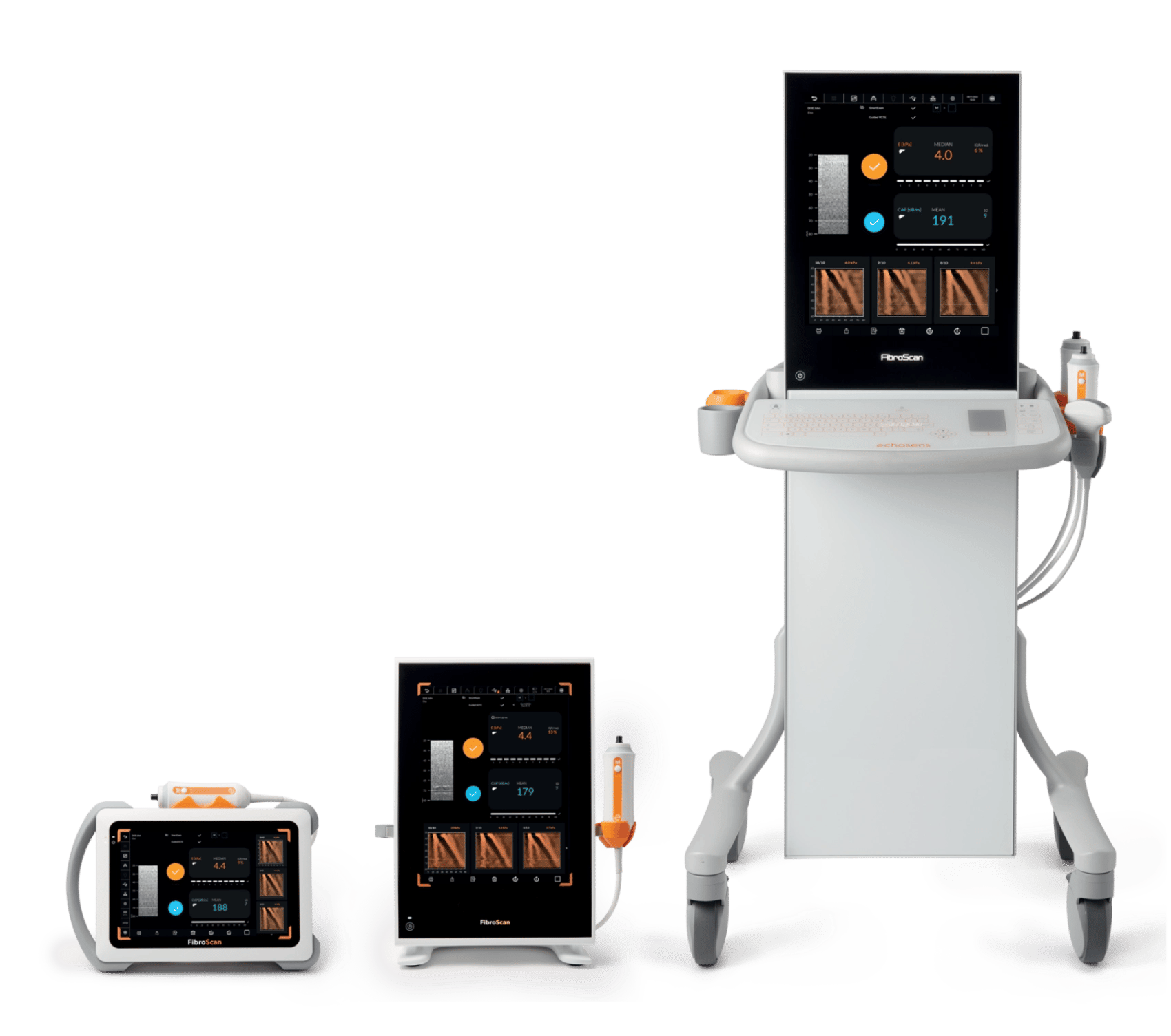 FibroScan transient elastography system for non-invasive liver stiffness measurement